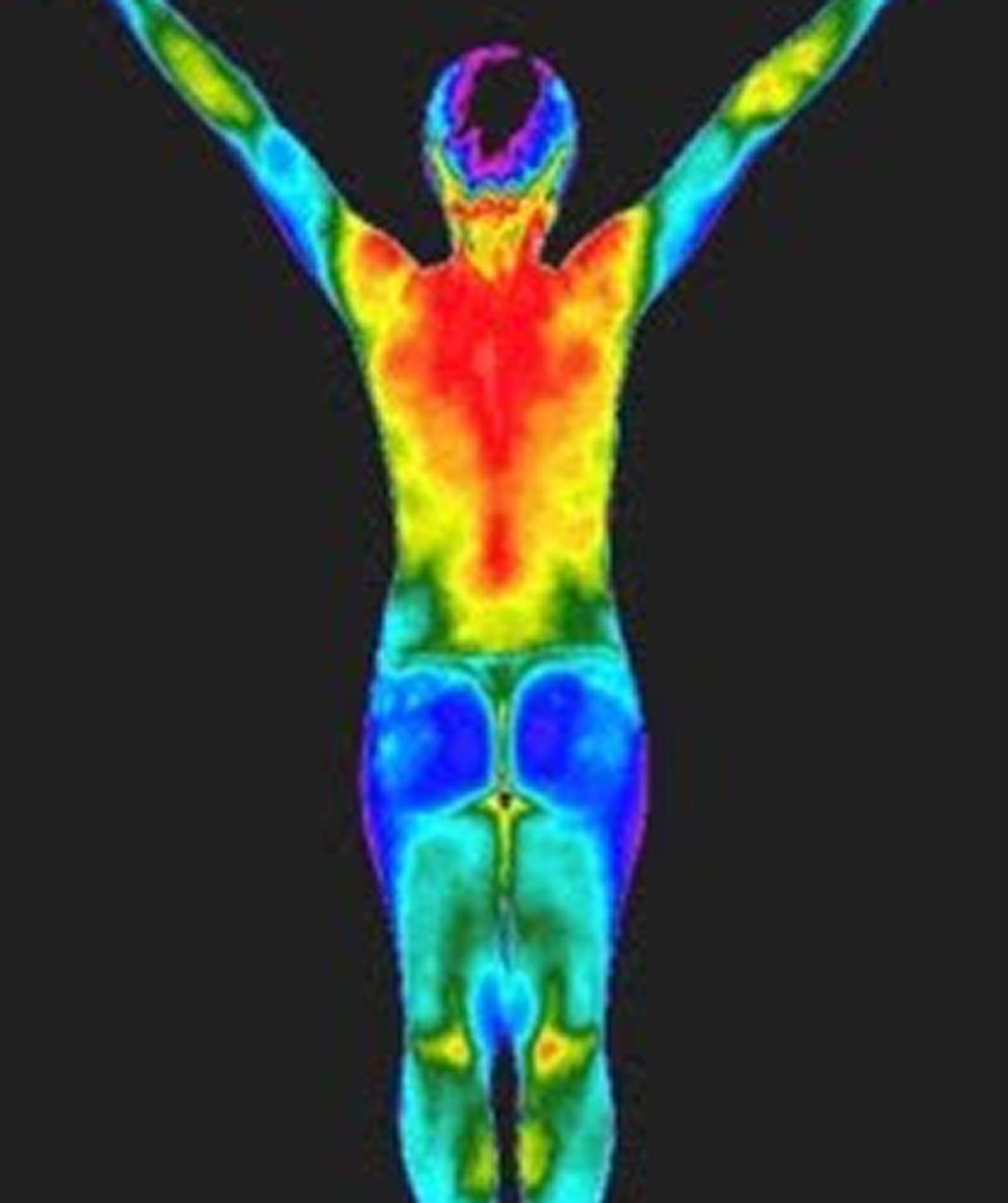 Example of a thermography scan, showing the heat patters of the body